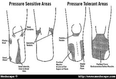 <p>Regions of limb that can bear weight.</p>