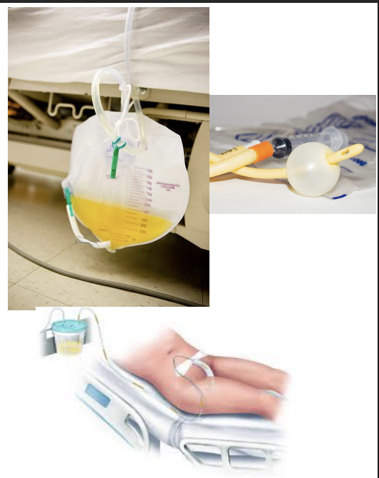 <p>Drain</p><p>Purpose: urine output monitoring/drainage</p>