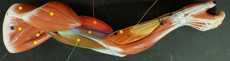 <p>Name the structure highlighted in RED</p>