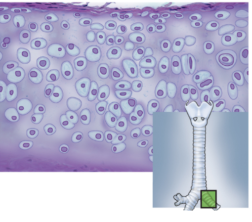 <p>What is the tissue shown</p>