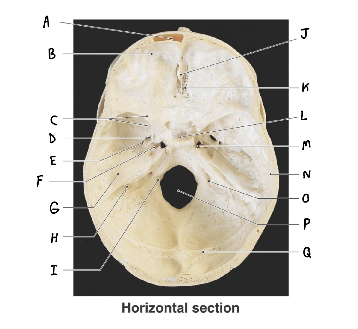 <p>P</p>
