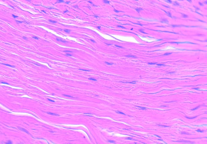 <p>name it → see it</p><p>parallel collagen fibers; lines, highly packed and the fibers run in the same direction, </p><ul><li><p>tendons and ligaments (achilles)</p></li></ul><p></p>