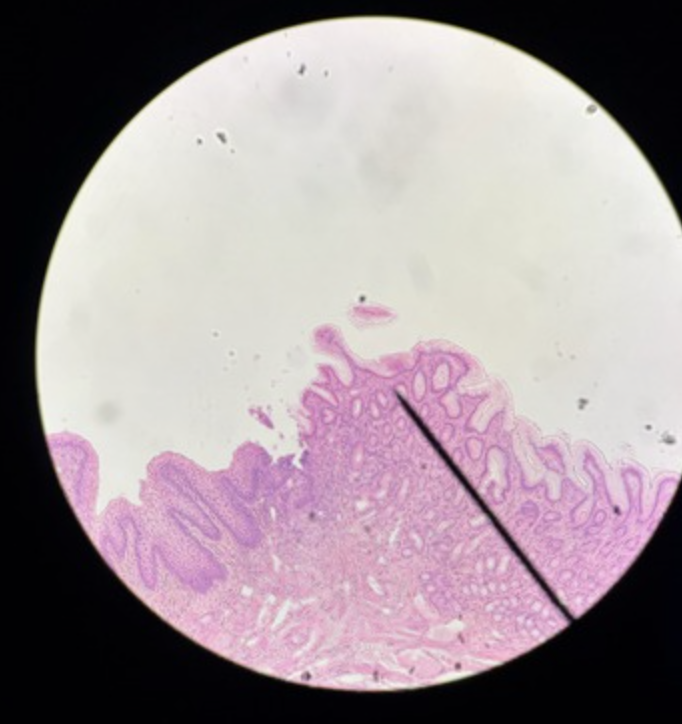 <p>Identify structure &amp; which side</p>