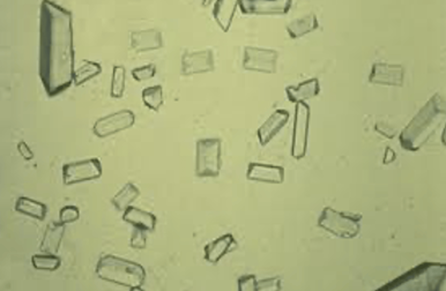 <p>Radio-opaque, "coffin-lid" crystals forming in alkaline urine and dissolved with acidification</p>