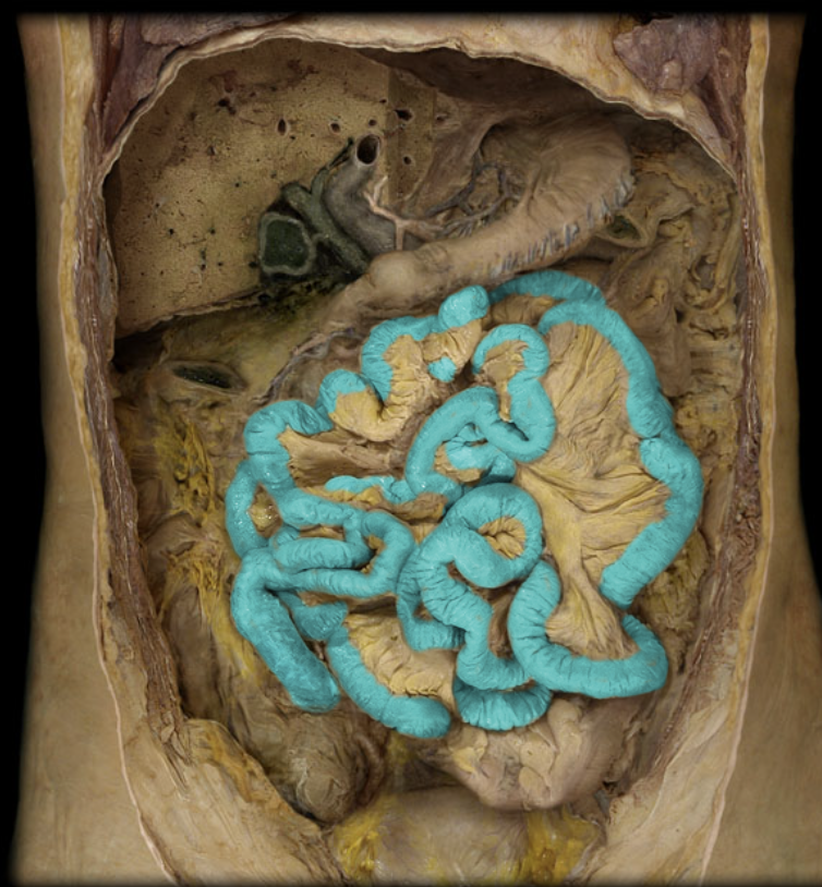 term image
