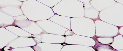 <p>Adipose Tissue</p>