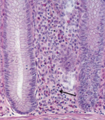 <p>Identify this tissue</p>