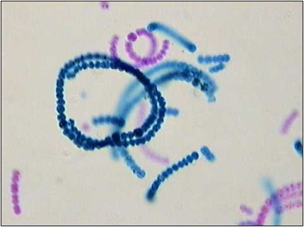 <p>This cyanobacteria formulates a bead-like chain</p>