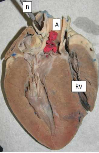 <p>Label A </p>