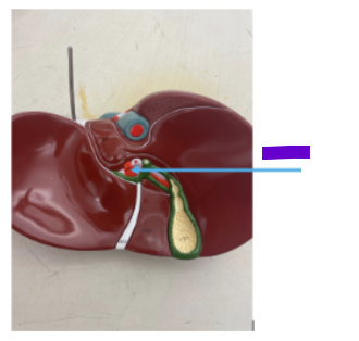 <p>What is the purple arrow?</p>