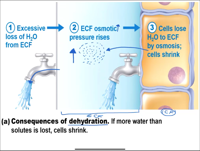 <p>ECF osmotic pressure rises, so cells shrink</p>