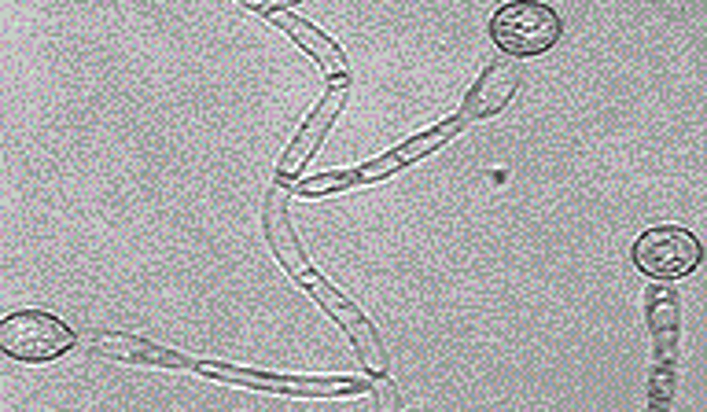 <p>Constriction(s)</p>