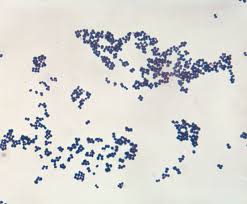 <p>Bacteria shape is in clusters</p>