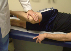 <p>Side-lying test hip flexed 60°, knee flexed, downward pressure; identifies piriformis syndrome.</p>