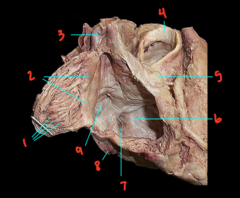 <p>What is labeled 7?</p>