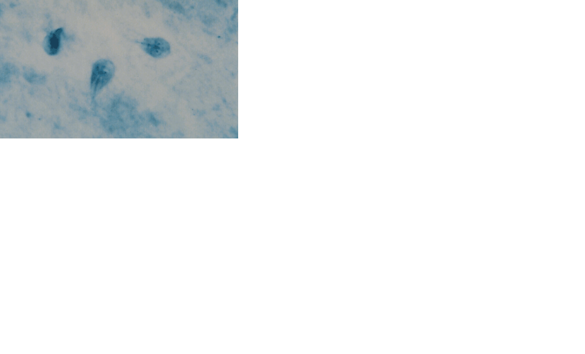<p>Name the protozoan</p>