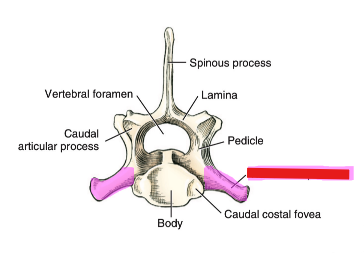 <p>Q: According to the diagram of the VERTEBRA ARCH, the structure that is highlighted in pink is the ......</p><p>A. Spinous process</p><p>B. Lamina</p><p>C. Pedicle</p><p>D. Transverse process</p>