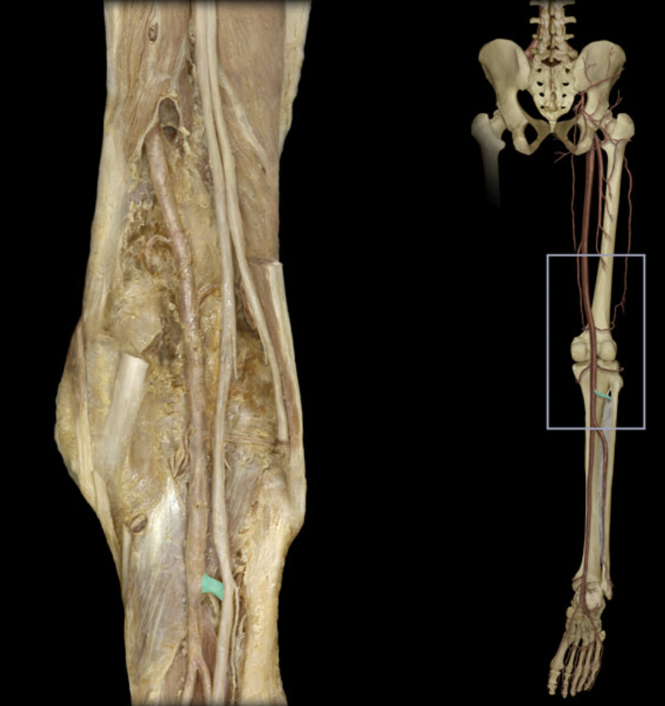 <p>Identify the blood vessel of the lower extremity</p>