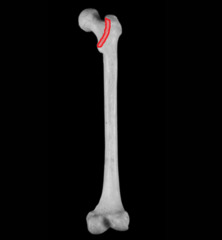<p>narrow ridge of bone; less prominent than a crest</p>