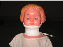 <p><span>cervical cast affection</span></p>