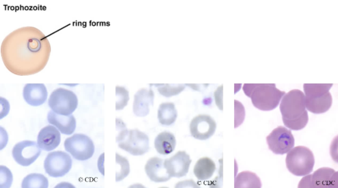 <ul><li><p>only infect mature RBCs (smaller cells) and have lower parasitic load. </p></li><li><p><span style="background-color: transparent;">Delicate cytoplasmic ring ⅙ RBC diameter connected by a heavy chromatin dot</span></p></li><li><p><span style="background-color: transparent;">Vacuole appears “filled in”</span></p></li><li><p><span style="background-color: transparent;">Pigment forms early</span></p></li><li><p><span style="background-color: transparent;">RBCs are not distorted</span></p></li></ul><p></p>