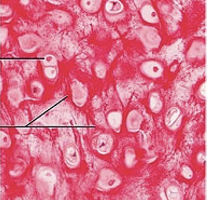 <p>Identify the type of cartilage</p>