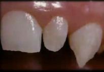<p>What are some reasons why a patient would want to modify their rooth shape or length?</p>