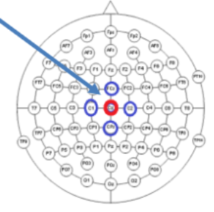 <p>Each EEG channel is an active electrode relative to weighted local average. For example, small Laplacian: Cz-(C1+C2+Fcz+Cpz)/4</p>