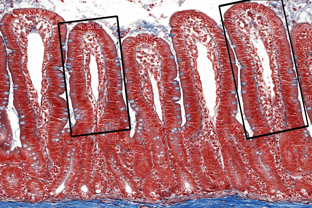 <p>Small Intestine</p><p><strong>NOTICE: THE FINGER-LIKE PROJECTIONS (VILLI) WITH OPEN SPACE INSIDE AND A FEW GRAY/BLUE GOBLET CELLS ALONG THE SIDES (NOT AS MANY AS LARGE INTESTINE</strong></p>