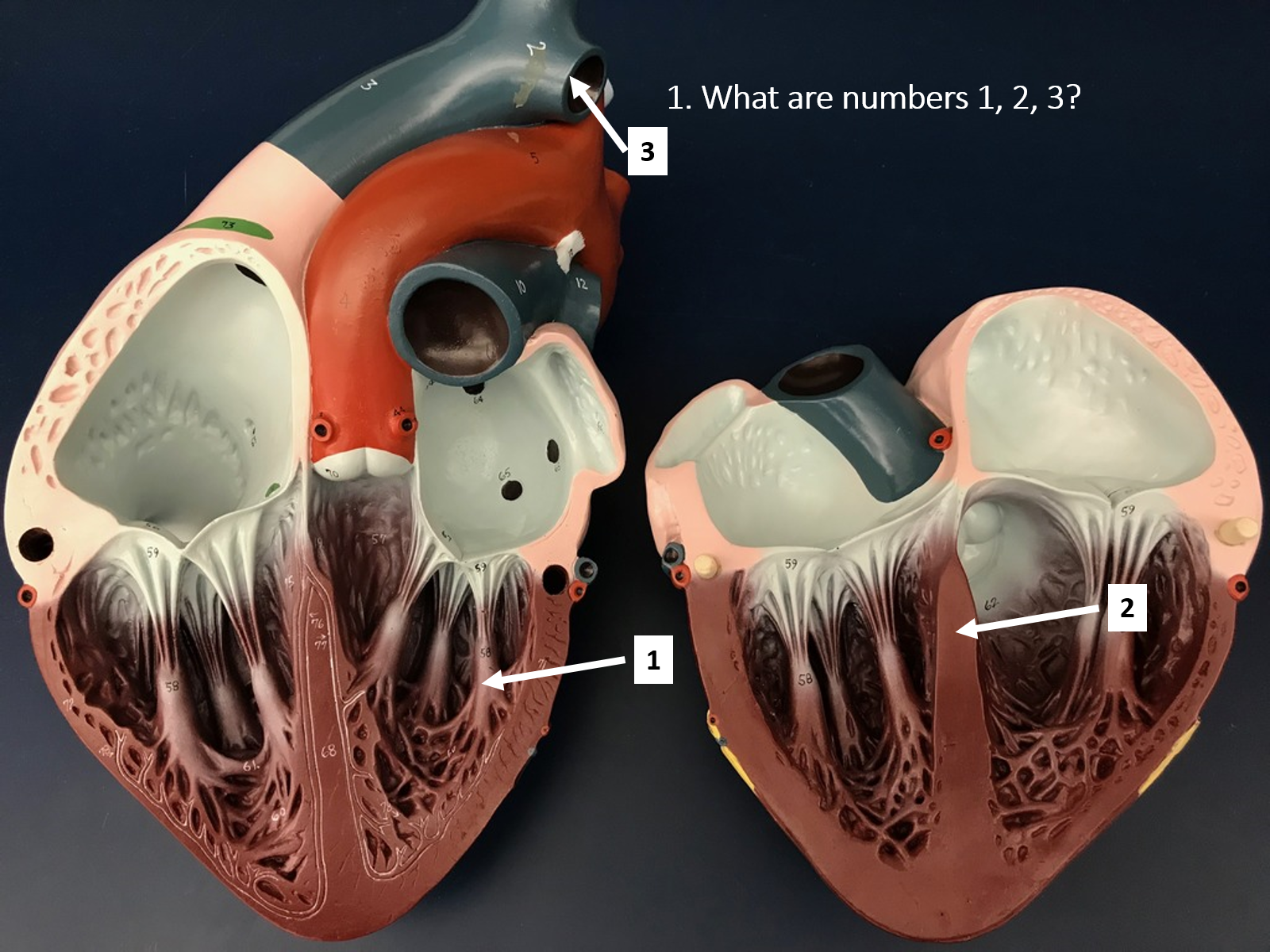 <p>What are numbers 1, 2, 3 ?</p>