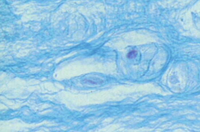 term image