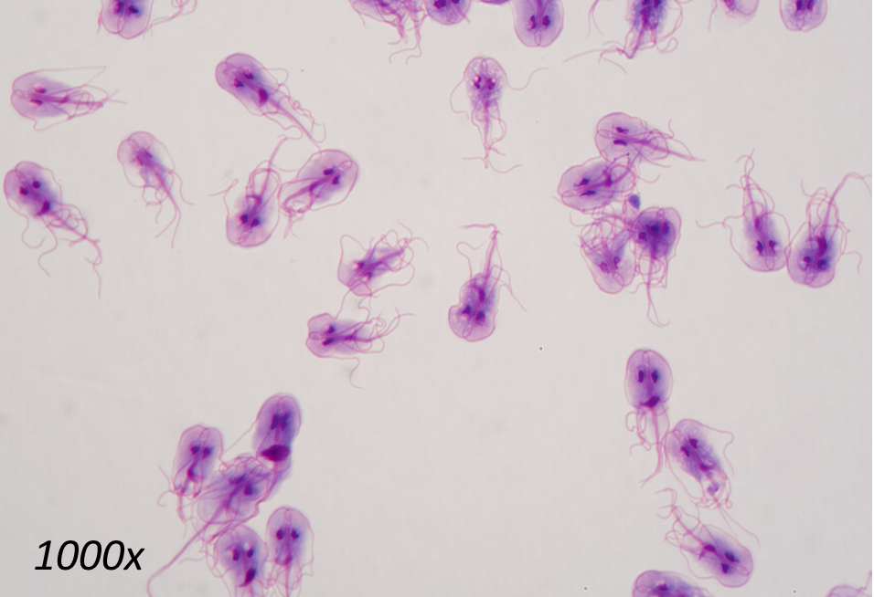 <p>What organism is this, is it a trophozoite or a cyst?</p>