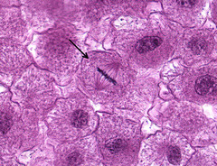 <p>What phase of mitosis is indicative of the cell at the arrow?</p>