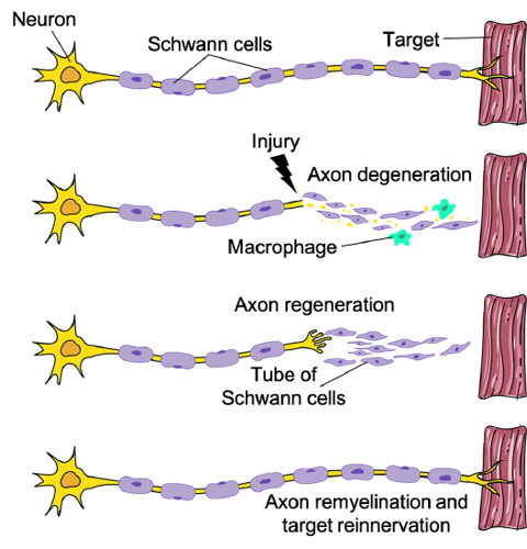 <p>-myelin is made from Schwann cells</p><p>-outer plasma membrane of a schwann forms nuerolemma</p><p>-PNS can regenerate</p><ul><li><p>IF cell body is intact, schwann’s are functional, n scar tissue formation isnt too rapid</p><ul><li><p>Distal axon degenerates, regen. Tube is formed by Schwann’s</p></li></ul></li></ul><p></p>