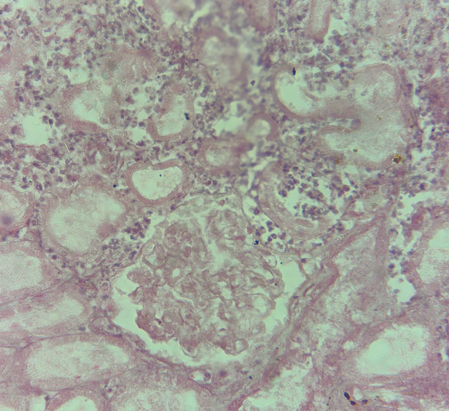 <p>diagnose, type of cell injury, reversible/irreversible</p>