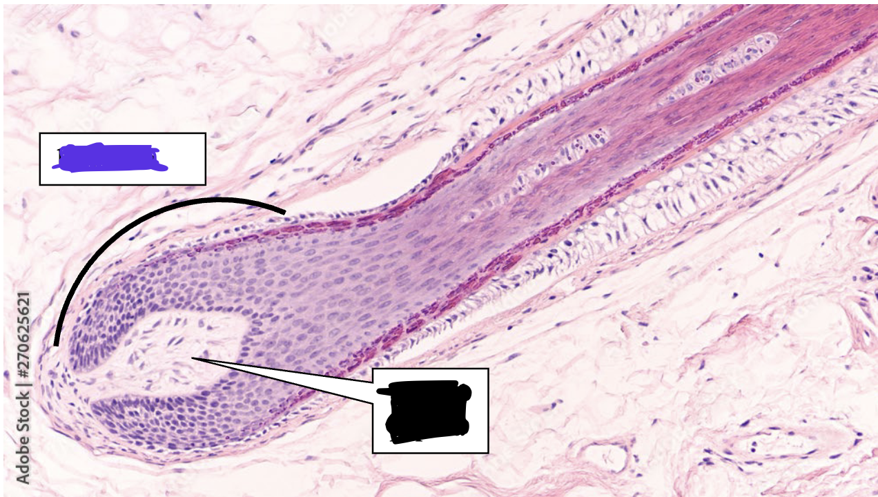 <p>What part of hair is this? In purple</p>