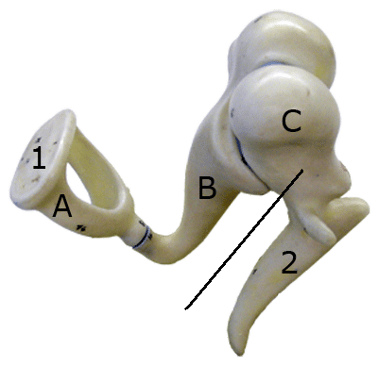 <p>a small bone in the middle ear that transmits vibrations of the eardrum to the incus. hammer; first of the three auditory ossicles of the middle ear</p>