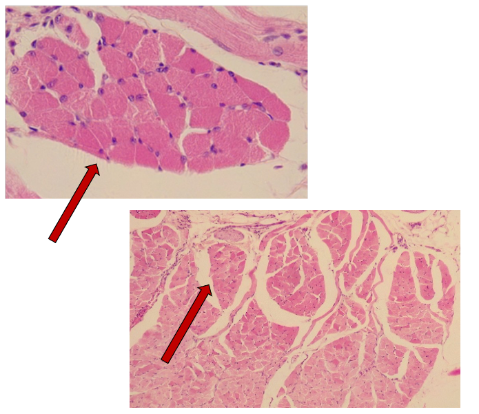 <p>connective tissue that surrounds each fascicle</p>