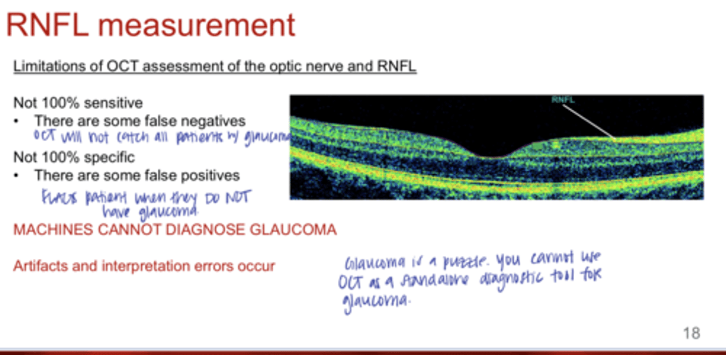<p>Can machines, such as OCT, diagnose glaucoma?</p>
