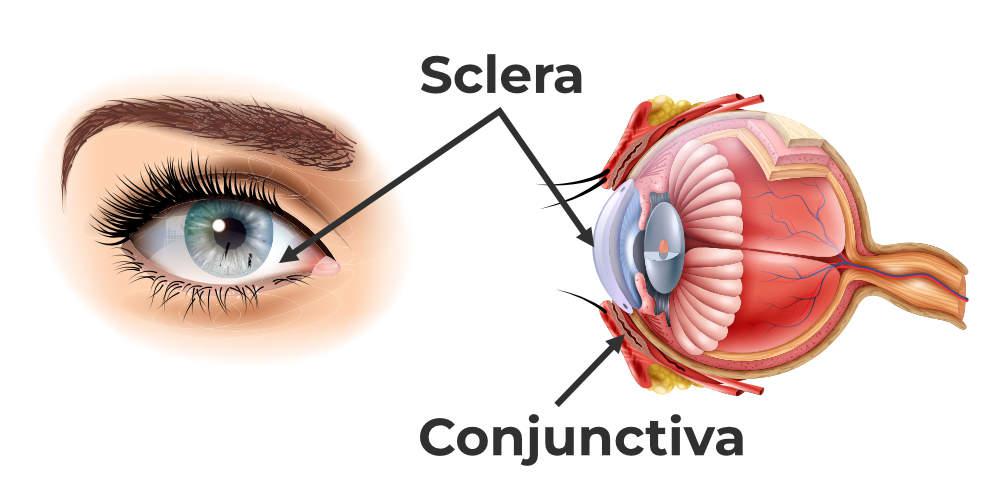 <p>Sclera</p>