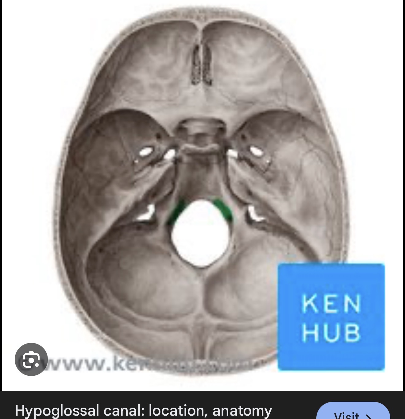 <p>what is this? R/L</p>