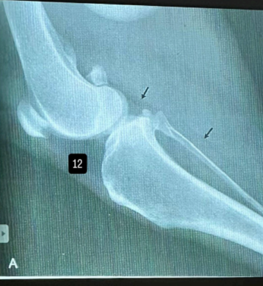 <p>podaj nazwę struktury </p>