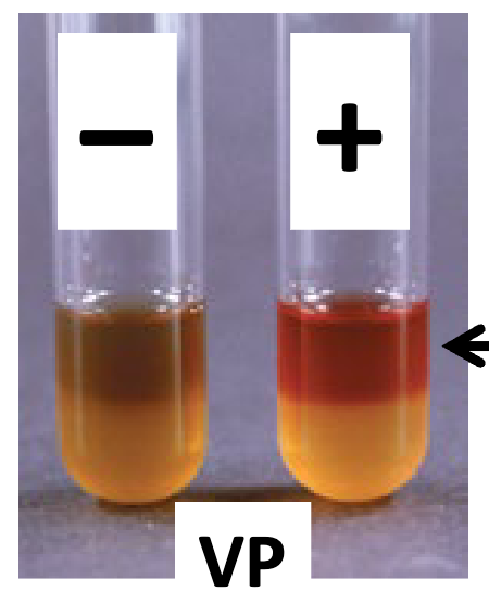 <p>Voges-Proskauer (VP):</p><ul><li><p>occurs fast or slow?</p></li><li><p>checks for ____</p></li><li><p>needs to add ____ reagents</p></li></ul><p></p>