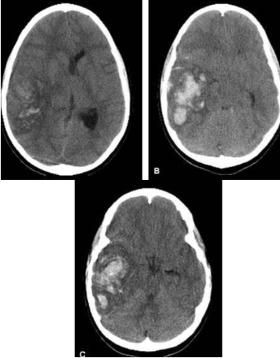 <p>what is the diagnosis?</p>