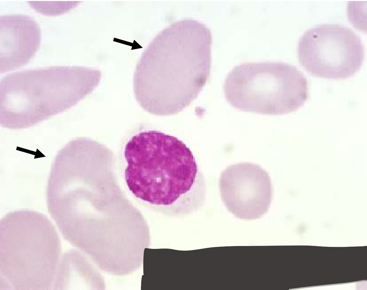 <p>Name this type of RBC</p><p></p>