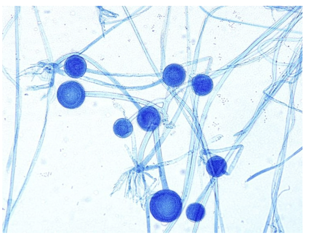 <p>-Rhizoids and unbranched sporangiophores</p><p>-Sporangiophores = sac of spores</p>