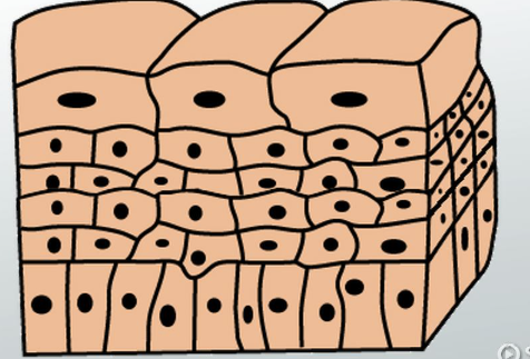 <p><span style="background-color: transparent;">Both the urinary bladder and ureters are internally lined with __________ __________ , a special kind of epithelium that allows for the cells to slide past each other during the distension of the bladder.</span></p>