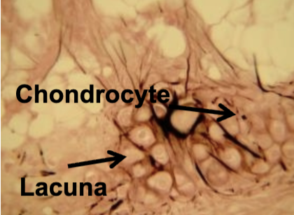 <p>What cartilage is this?</p>