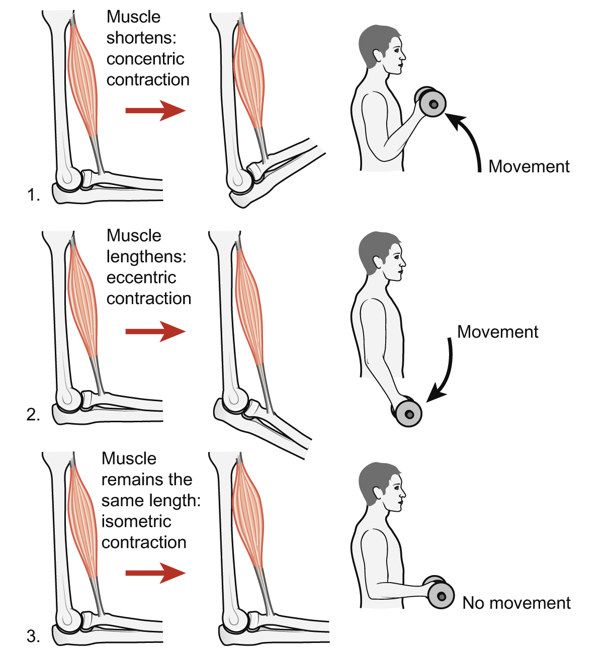 <p><strong>Concentric contraction</strong> </p><ul><li><p>Muscle <strong>shortens while generating force</strong></p></li><li><p>Movement occurs because the <strong>muscle pulls the insertion toward the origin</strong></p></li><li><p>Produces visible motion at the joint</p></li><li><p>Example:</p><ul><li><p>lifting a dumbbell during a biceps curl (elbow flexion)</p></li></ul></li></ul><p> <strong>Eccentric contraction</strong> </p><ul><li><p>Muscle <strong>lengthens while still producing force</strong></p></li><li><p>Happens when the muscle is <strong>actively resisting a load</strong></p></li><li><p>Controls or slows movement rather than creating it</p></li><li><p>Example:</p><ul><li><p>lowering a dumbbell slowly during a biceps curl</p></li></ul></li></ul><p> <strong>Isometric contraction</strong> </p><ul><li><p>Muscle <strong>produces force without changing length</strong></p></li><li><p>No joint movement occurs, but tension is generated</p></li><li><p>Used for <strong>stabilization and posture</strong></p></li><li><p>Example:</p><ul><li><p>holding a weight still at 90° elbow flexion</p></li><li><p>maintaining posture while standing</p></li></ul></li></ul><p></p>