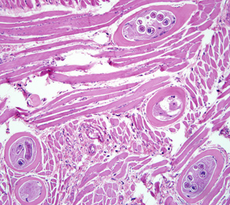 <p>Trichinella spiralis Juvenile in Muscle</p>